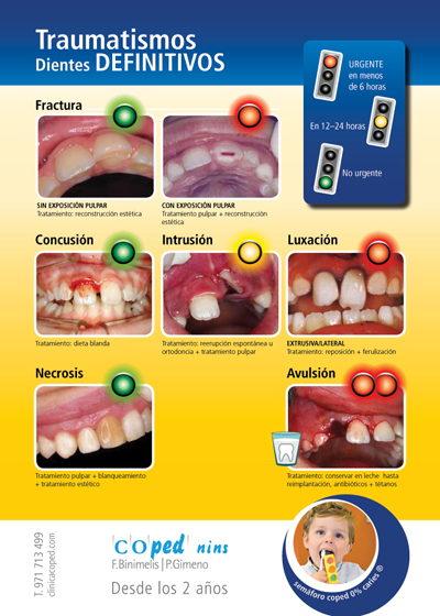 Traumatismos coped nins dientes definitivos