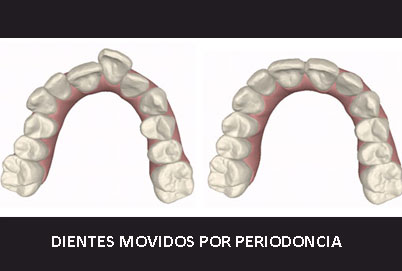 MOVIDOS POR PERIOn