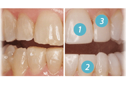 pasos NOSEVE plantilla foto destacada WEB pasos NOSEVE plantilla foto destacada WEB