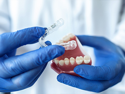 te interesa invisalign te interesa invisalign
