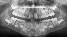 prevenir ortodoncia coped4363